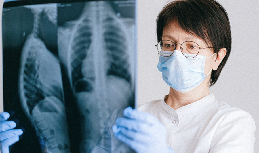 Yeni Akciğer Kanseri Tedavileri 2022