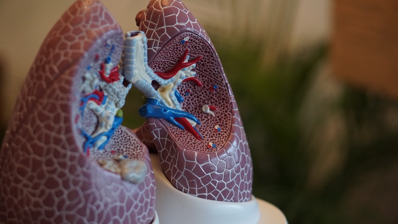 Akciğer kanseri tedavisi olarak fruquintinib: Henüz varmadık mı?