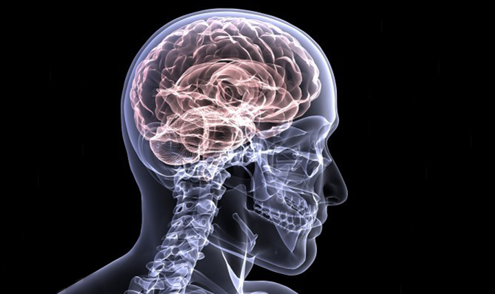 İnsan beyninin röntgeni 